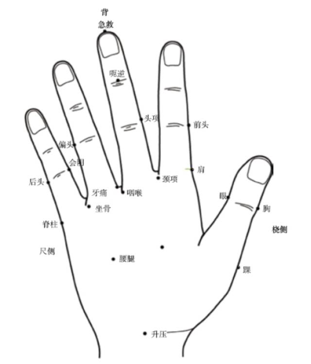 疼痛不用再挠墙，手针治痛，简单又实用-第1张图片-中国中医健康网